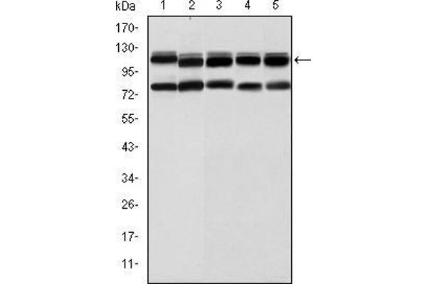 BMPR2 antibody
