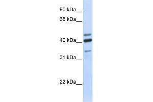 WB Suggested Anti-HYAL1 Antibody Titration:  0. (HYAL1 antibody  (N-Term))
