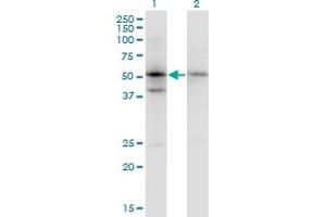 Western Blot analysis of SERPINB1 expression in transfected 293T cell line by SERPINB1 monoclonal antibody (M02), clone 4D7. (SERPINB1 antibody  (AA 201-300))