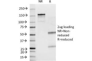 SDS-PAGE Analysis Purified Insulin Mouse Monoclonal Antibody (E2-E3). (Insulin antibody)