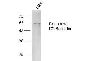U251 lysates probed with Rabbit Anti-DRD2 Polyclonal Antibody, Unconjugated  at 1:5000 for 90 min at 37˚C. (Dopamine d2 Receptor antibody  (AA 201-300))