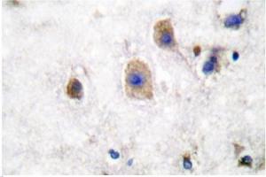 Image no. 2 for anti-Ephrin B3 (EFNB3) antibody (ABIN265403) (Ephrin B3 antibody)