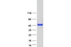 Validation with Western Blot
