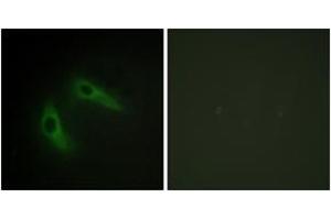 Immunofluorescence analysis of HeLa cells, using KCIP1 Antibody. (14-3-3 zeta antibody  (AA 1-50))