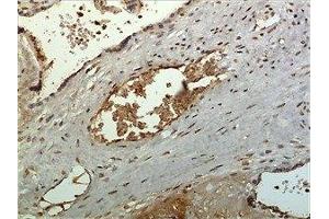 Immunohistochemistry (IHC) image for anti-Chemokine (C-C Motif) Ligand 27 (CCL27) (AA 25-112) antibody (ABIN1983065) (CCL27 antibody  (AA 25-112))