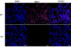 anti-3-hydroxyisobutyryl-CoA Hydrolase (HIBCH) antibody