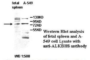 Image no. 1 for anti-Platelet-Derived Growth Factor CC (PDGFCC) antibody (ABIN790864) (Platelet-Derived Growth Factor CC (PDGFCC) antibody)