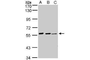 WB Image Sample(30 ug whole cell lysate) A:293T B:H1299 C:Hep G2 , 7. (Arylsulfatase E antibody  (C-Term))