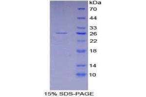 SDS-PAGE (SDS) image for Glutathione S-Transferase alpha 4 (GSTA4) (AA 1-222) protein (His tag) (ABIN1079698)