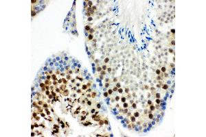 Anti- MCAK antibody, IHC(P) IHC(P): Mouse Testis Tissue (KIF2C antibody  (AA 531-725))