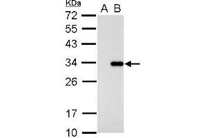 WB Image CDK2 antibody [N1C3] detects CDK2 protein by western blot analysis. (CDK2 antibody)