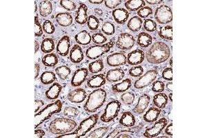 Immunohistochemical staining of human kidney with C19orf40 polyclonal antibody  shows strong cytoplasmic positivity in renal tubules. (C19orf24 antibody)
