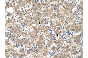 PPIB antibody was used for immunohistochemistry at a concentration of 4-8 ug/ml to stain Hepatocytes (arrows) in Human Liver. (PPIB antibody)