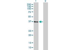 Western Blot analysis of LZTFL1 expression in transfected 293T cell line by LZTFL1 MaxPab polyclonal antibody. (LZTFL1 antibody  (AA 1-299))