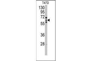 Image no. 1 for anti-Cytochrome P450, Family 2, Subfamily C, Polypeptide 8 (CYP2C8) (N-Term) antibody (ABIN360416) (CYP2C8 antibody  (N-Term))