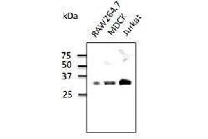 Anti-Rab35 Ab at 1/500 dilution, 293HEK transfected With GFP-Rab35, tysates at 100 µg per Iane, rabbit polyclonal to goat lµg (HRP) at 1/10,000 dilution, (RAB9B antibody  (C-Term))