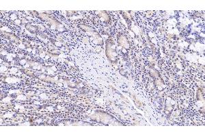 Detection of SOD3 in Human Small intestine Tissue using Monoclonal Antibody to Superoxide Dismutase 3, Extracellular (SOD3) (SOD3 antibody  (AA 19-240))