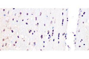 Immunohistochemistry of paraffin-embedded Rat brain using PCIF1 Polyclonal Antibody at dilution of 1:100 (40x lens).