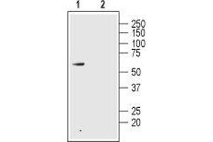 Western blot analysis of rat colon lysate: - 1. (GLP2R antibody  (1st Extracellular Loop))