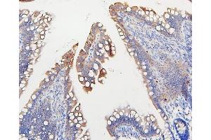IHC analysis of IFNAR2 using anti-IFNAR2 antibody (ABIN7601353). (IFNAR2 antibody  (AA 33-466))
