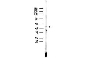anti-Growth Differentiation Factor 3 (GDF3) (Internal Region) antibody