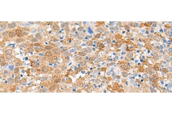 FANCB antibody