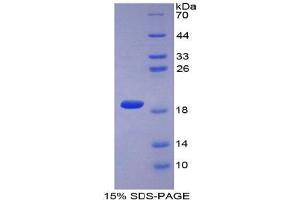SDS-PAGE analysis of Mouse COL2A1 Protein. (COL2A1 Protein)