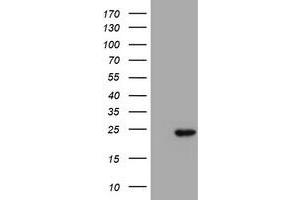 HEK293T cells were transfected with the pCMV6-ENTRY control (Left lane) or pCMV6-ENTRY PSMB9 (Right lane) cDNA for 48 hrs and lysed. (PSMB9 antibody  (AA 21-219))