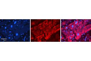 Rabbit Anti-AGPAT2 Antibody Catalog Number: ARP44636_P050 Formalin Fixed Paraffin Embedded Tissue: Human heart Tissue Observed Staining: Cytoplasmic Primary Antibody Concentration: N/A Other Working Concentrations: 1:600 Secondary Antibody: Donkey anti-Rabbit-Cy3 Secondary Antibody Concentration: 1:200 Magnification: 20X Exposure Time: 0. (AGPAT2 antibody  (C-Term))