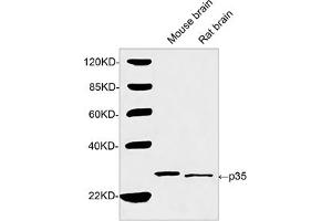 Western blot analysis of tissue lysates using 2 µg/mL Rabbit Anti-p35 Polyclonal Antibody (ABIN398903) The signal was developed with IRDyeTM 800 Conjugated Goat Anti-Rabbit IgG. (P35 (N-Term) antibody)