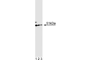 Western Blotting (WB) image for anti-HNF1 Homeobox B (HNF1B) (AA 1-101) antibody (ABIN968855) (HNF1B antibody  (AA 1-101))