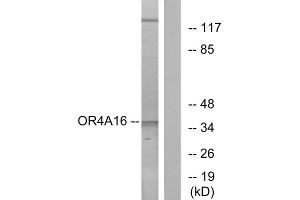 Western blot analysis of extracts from COLO cells, using OR4A16 antibody. (OR4A16 antibody  (C-Term))
