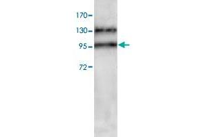 Western blot analysis of HeLa cell lysate with ADAM17 polyclonal antibody  at 1 : 200 dilution. (ADAM17 antibody  (C-Term))