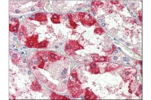 Kidney, Human: Formalin-Fixed, Paraffin-Embedded (FFPE) (Clathrin Heavy Chain (CLTC) (Heavy Chain) antibody)