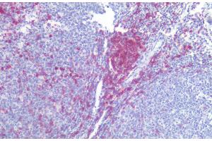 Immunohistochemistry staining of human tonsil (paraffin-embedded sections) with anti-CD5 (L17F12), 10 μg/mL. (CD5 antibody)