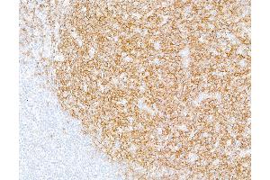 Immunohistochemistry (IHC) image for anti-CD19 Molecule (CD19) (AA 21-291) antibody (ABIN7449425) (Recombinant CD19 antibody  (AA 21-291))