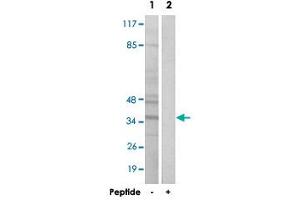 Western blot analysis of extracts from Jurkat cells, using BNIP2 polyclonal antibody . (BNIP2 antibody  (C-Term))