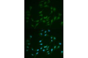 Immunofluorescence analysis of MCF-7 cells using LIG1 antibody. (LIG1 antibody  (AA 565-790))