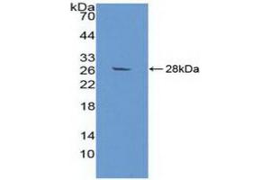 Western Blotting (WB) image for anti-alpha-2-Glycoprotein 1, Zinc-Binding (AZGP1) (AA 148-298) antibody (ABIN7438511)