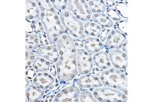 Immunohistochemistry of paraffin-embedded rat kidney using MonoMethyl-Histone H3-K27 Rabbit pAb (ABIN3023262, ABIN3023263, ABIN3023264, ABIN1513004 and ABIN6219518) at dilution of 1:100 (40x lens). (Histone 3 antibody  (H3K27me1))