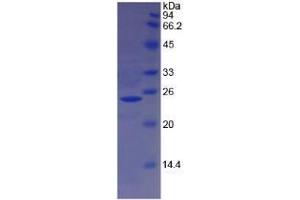 SDS-PAGE analysis of Sheep Hemoglobin beta Protein.