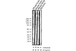 Western Blotting (WB) image for anti-Microtubule-Associated Protein tau (MAPT) (pThr205) antibody (ABIN6255625)