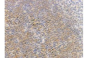 ABIN6257482 and ABIN6275890 at 1/100 staining human normal tonsil tissue by IHC-P.
