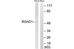 Western blot analysis of extracts from HeLa cells, using RSAD1 Antibody. (RSAD1 antibody  (AA 298-347))