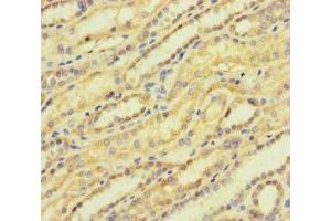 Immunohistochemistry of paraffin-embedded human kidney tissue using ABIN7143108 at dilution of 1:100 (ACTR5 antibody  (AA 183-285))