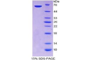 Image no. 1 for Centromere Protein I (CENPI) (AA 321-579) protein (His tag,GST tag) (ABIN6237911) (CENPI Protein (AA 321-579) (His tag,GST tag))