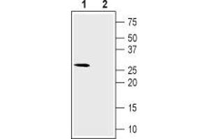 Western blot analysis of rat skeletal muscle lysate: - 1. (CACNG6 antibody  (1st Extracellular Loop))