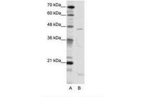 Image no. 1 for anti-Thyroid Hormone Receptor Interactor 13 (TRIP13) (C-Term) antibody (ABIN202512) (TRIP13 antibody  (C-Term))