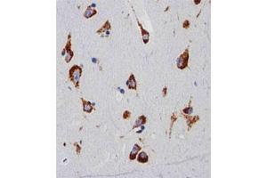 Immunohistochemical staining of paraffin-embedded human brain section reacted with RPS6 monoclonal antibody  at 1:25 dilution. (RPS6 antibody)