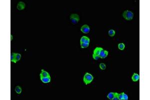 Immunofluorescent analysis of MCF-7 cells using ABIN7169819 at dilution of 1:100 and Alexa Fluor 488-congugated AffiniPure Goat Anti-Rabbit IgG(H+L) (SLIT-ROBO rho GTPase Activating Protein 2B (SRGAP2B) (AA 79-150) antibody)